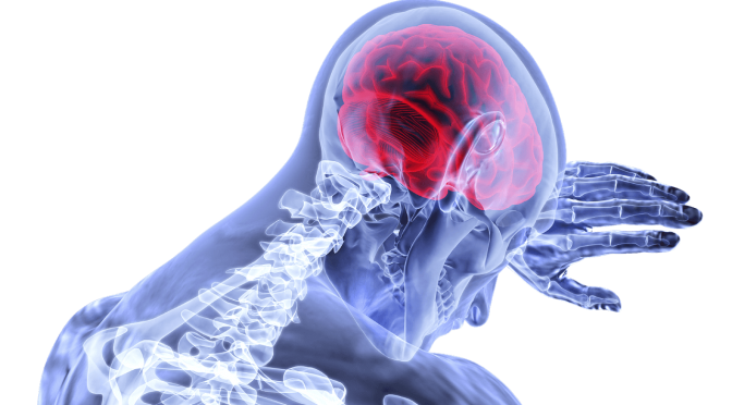 Scan eines Kopfes mit Gehirn